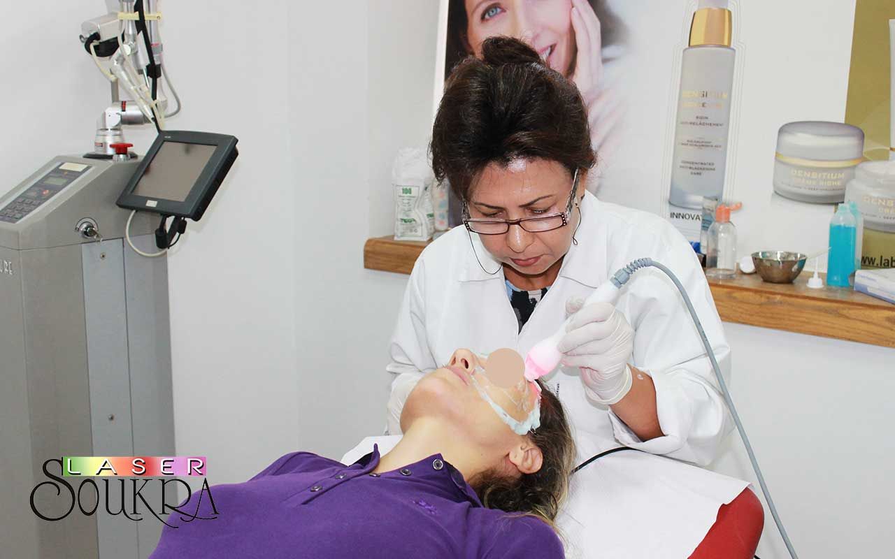 Séance de Radiofréquence au centre Soukra Laser